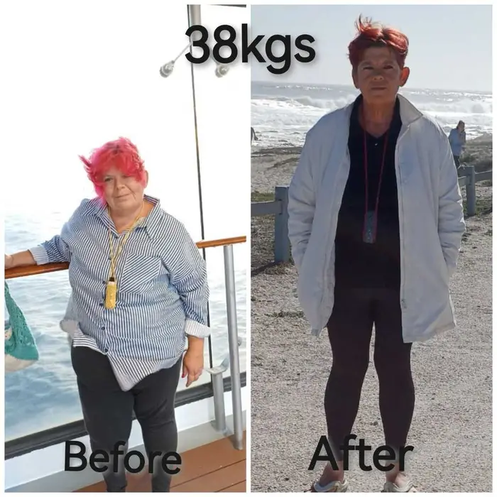 Carmen before and after