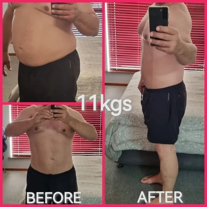 Karl before and after