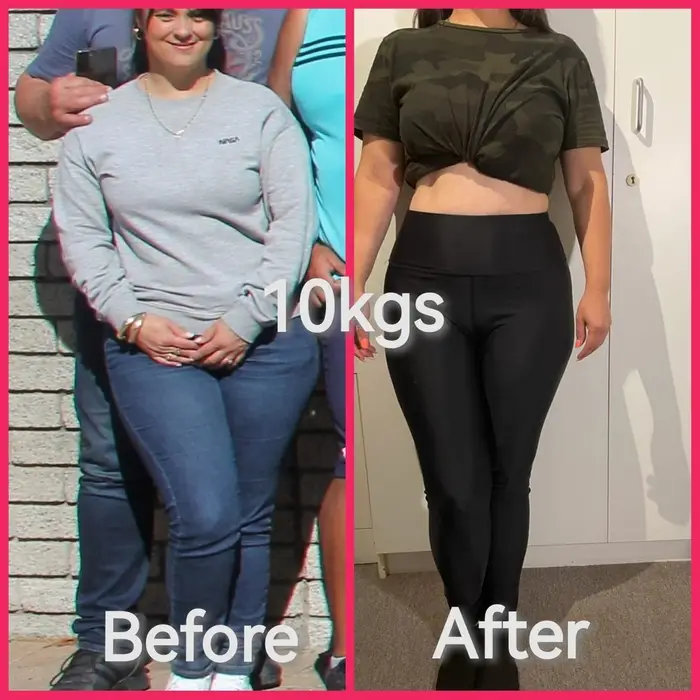 Migs before and after
